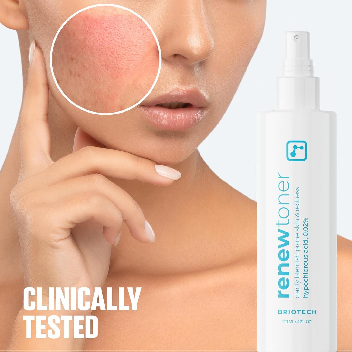 BRIOTECH Renew Toner, Hypochlorous Acid Spray, Minimize Appearance of Blemishes, Soothing Facial Mist for Sensitive Skin, Calm Redness & Bumps, Vegan, 4 fl oz