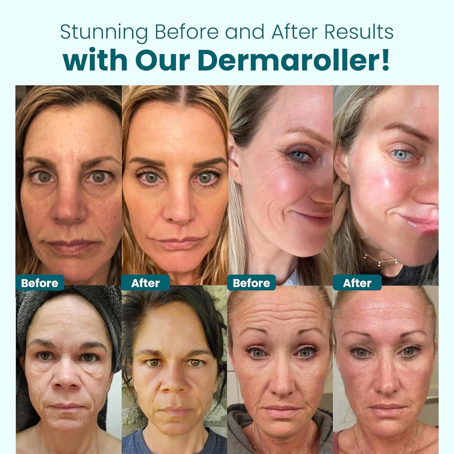 Gin Amber Beauty Derma Roller with Replaceable Head Design – 192 Real individual needles, Micro Needling Roller for Face, Beard, and Scalp Care, 0.25mm Face Roller