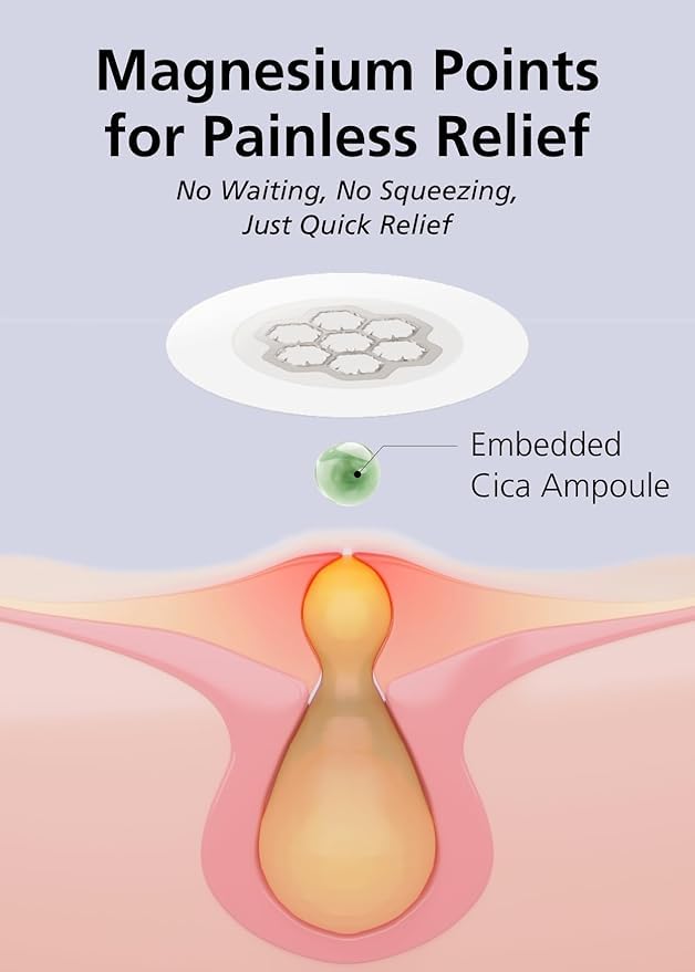 EasyDerm Quick Calming Magnesium Patches – 40 Patches (4 Pack), Hydrocolloid Acne Spot Treatment with Tea Tree & Cica, Bulk Value Pack for Acne-Prone Skin, Ideal for Home Skincare