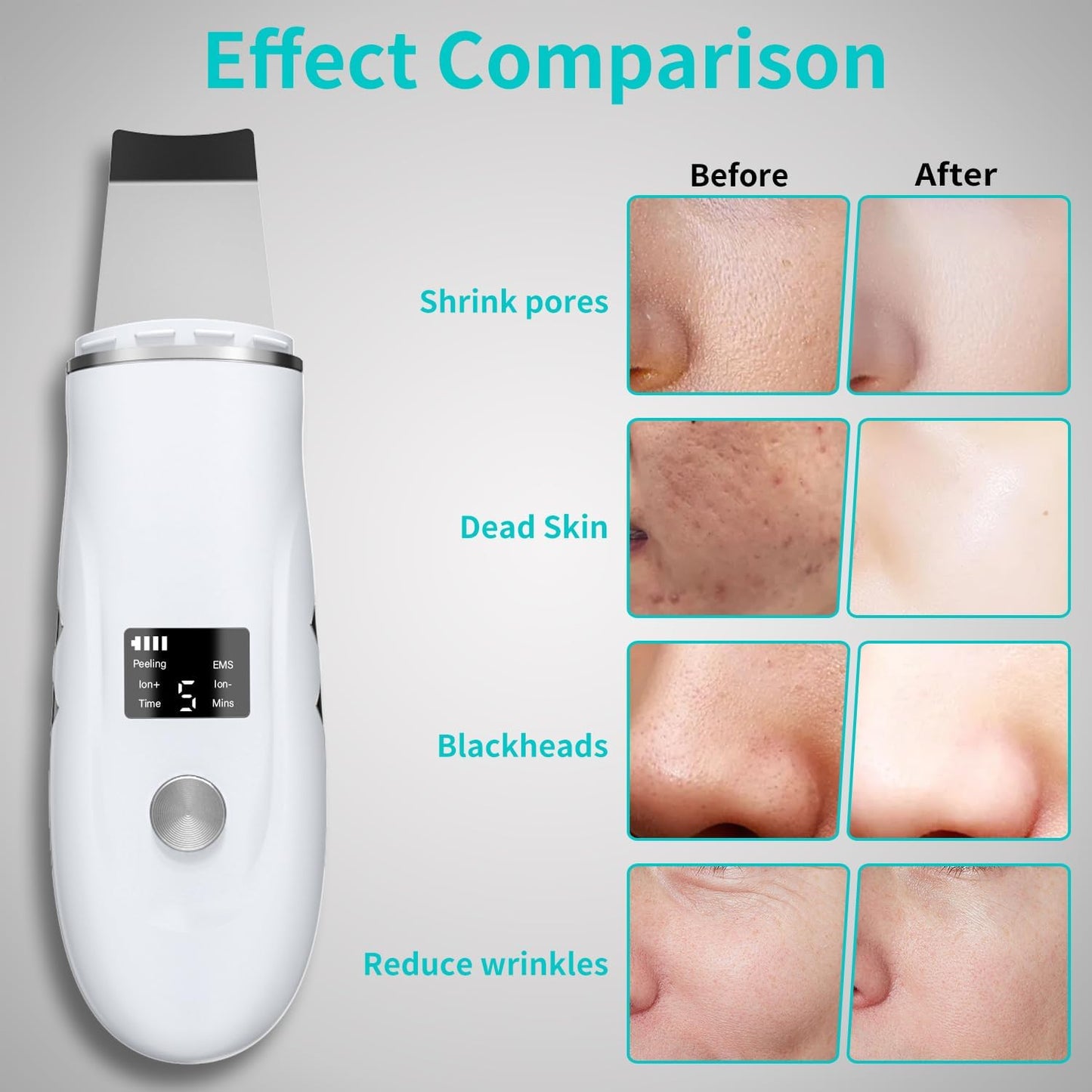 Skin Scrubber Face Spatula - 4-in-1 Deep Cleansing Tool for Pore Extraction, Fast Charging Dock Blackhead Remover Face Spatula for Facial Skincare Women Gift (White)