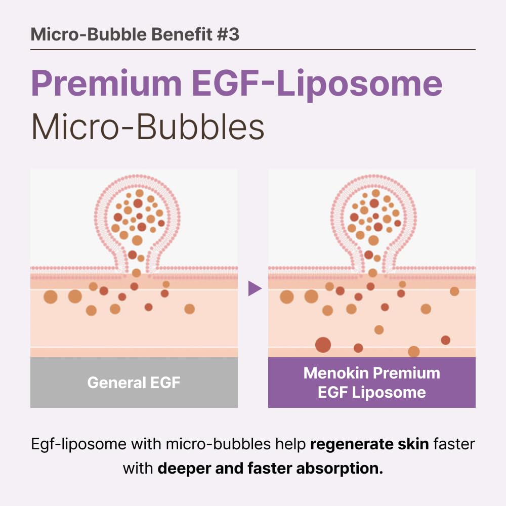 MENOKIN 30 Seconds Quick Bubble Mask [REPAIR] - [EGF Liposome] in Micro-bubbles for Skin Restoration, Hypoallergenic Bubble Capsule for Deep Repair, Korean Skin Care Essential, 50 Uses, 2.36 fl.oz