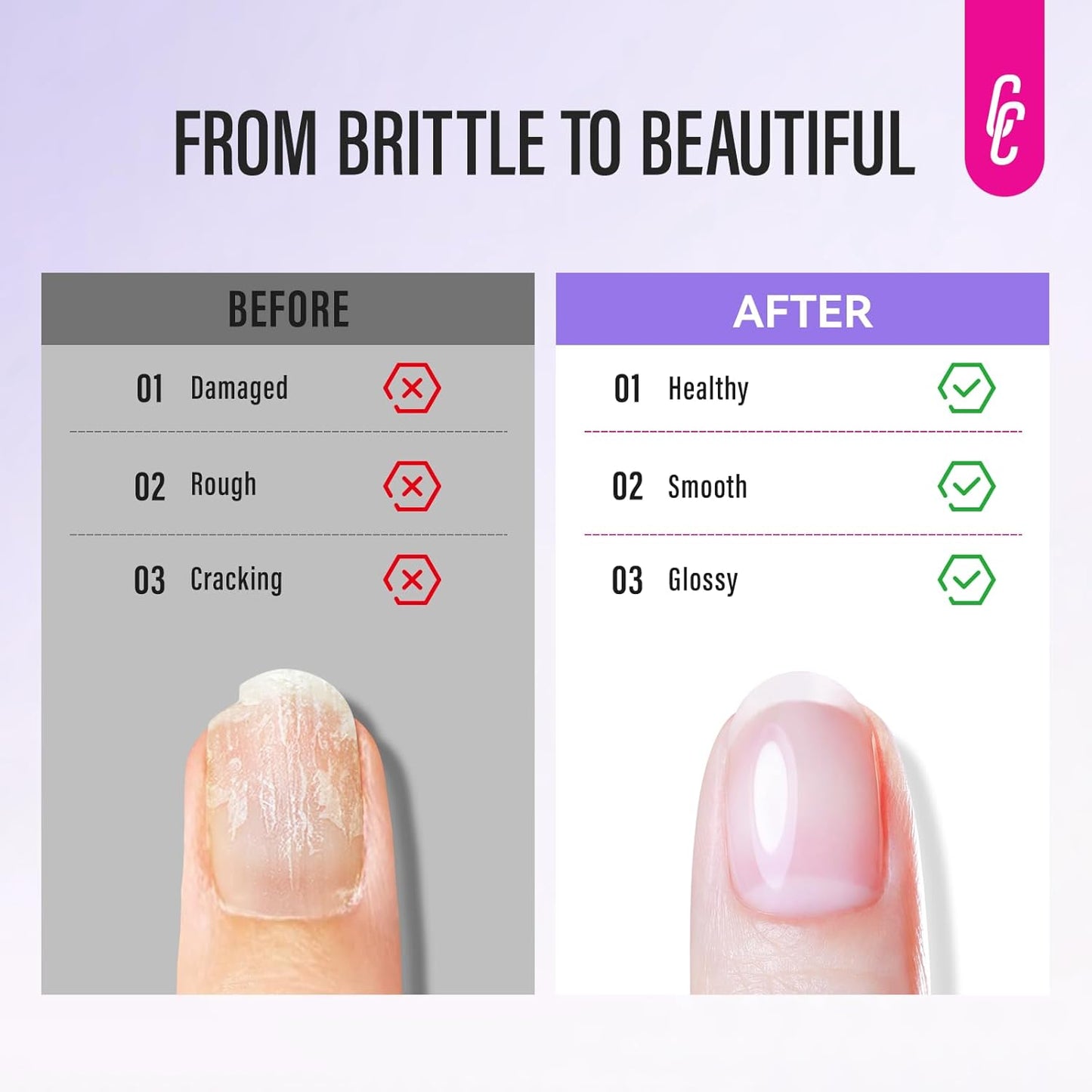 Nail Strengthener and Growth: Milky White Hardener and Repair & Cuticle Softener Set - Protein Ridge Filler Polish Quick Dry for Weak Peeling Brittle Nails - for Women Home Salon