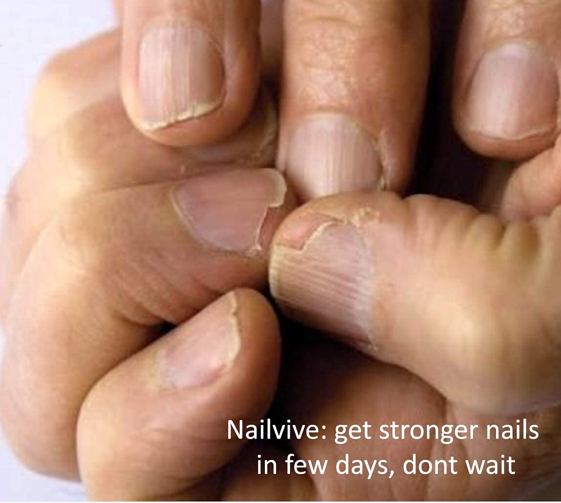 NAILVIVE Nail Serum Natural Keratin Nail Treatment Silk Proteins Proven Natural Formula Strengthening Hardening nails Instantly Prevents Splits Chips Peels Cracks on Your Nails