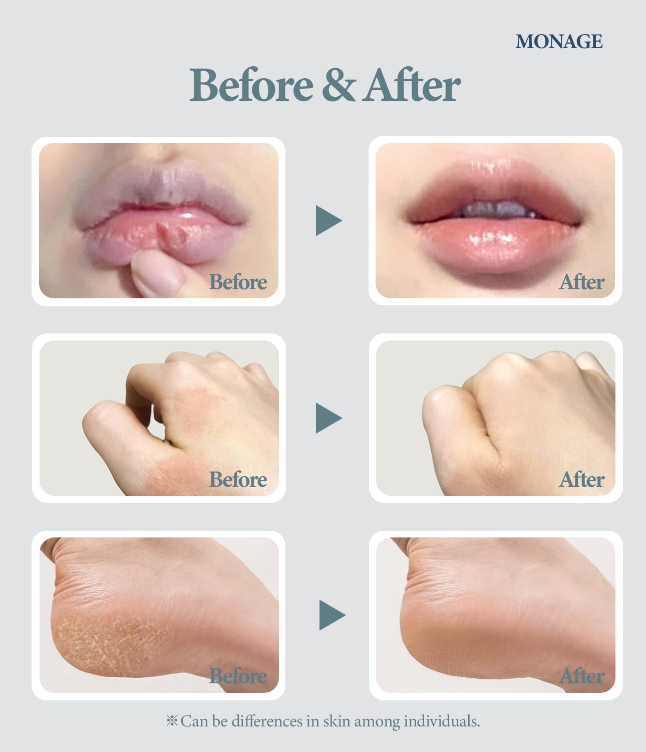 Korea Vegan & Nourishing & Moisturizing Lip Care Made from 100% Natural Ingredients, Organic Moisturizer for Dry, Cracked Lips & Skin, Everyday Lip Balm, Daily, 0.38 Ounce