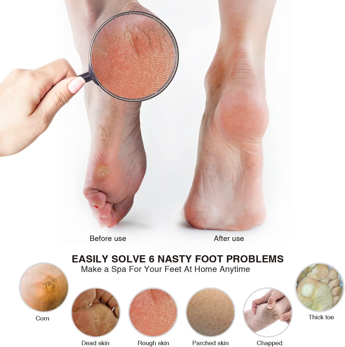 AM 8:00Pumice Stone Foot File, 2 Pack Callus Remover (coarse/fine) for Feet with Wooden Handle, Pedicure Foot Scrubber to Remove Dead Skin, Dry, Rough, Corns Skin Scraper