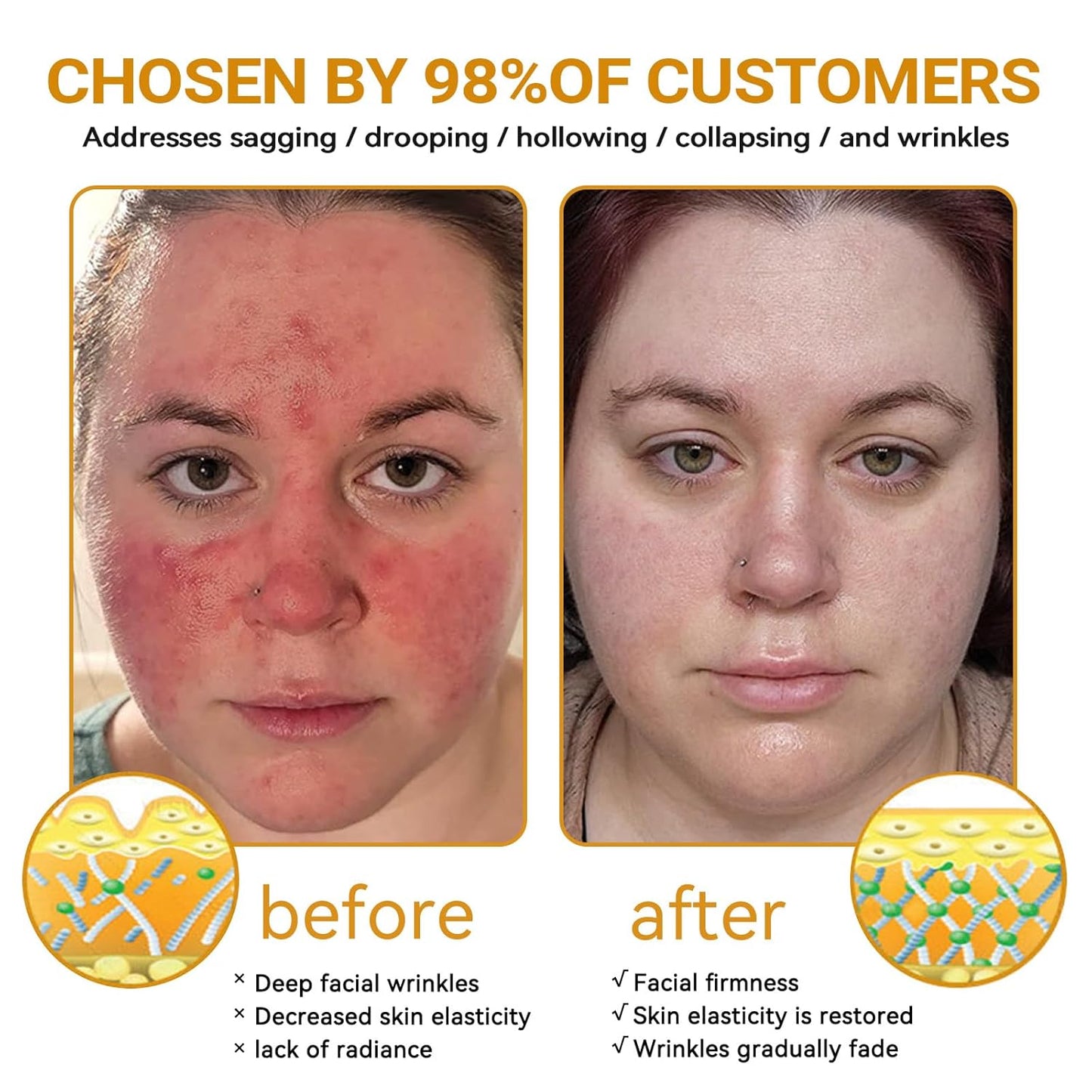 Bee Venom Skin Restoration Cream, Bee Venom Skin Treatment Cream, Repair skin and Firming, Effective In Reducing Blemishes (3)