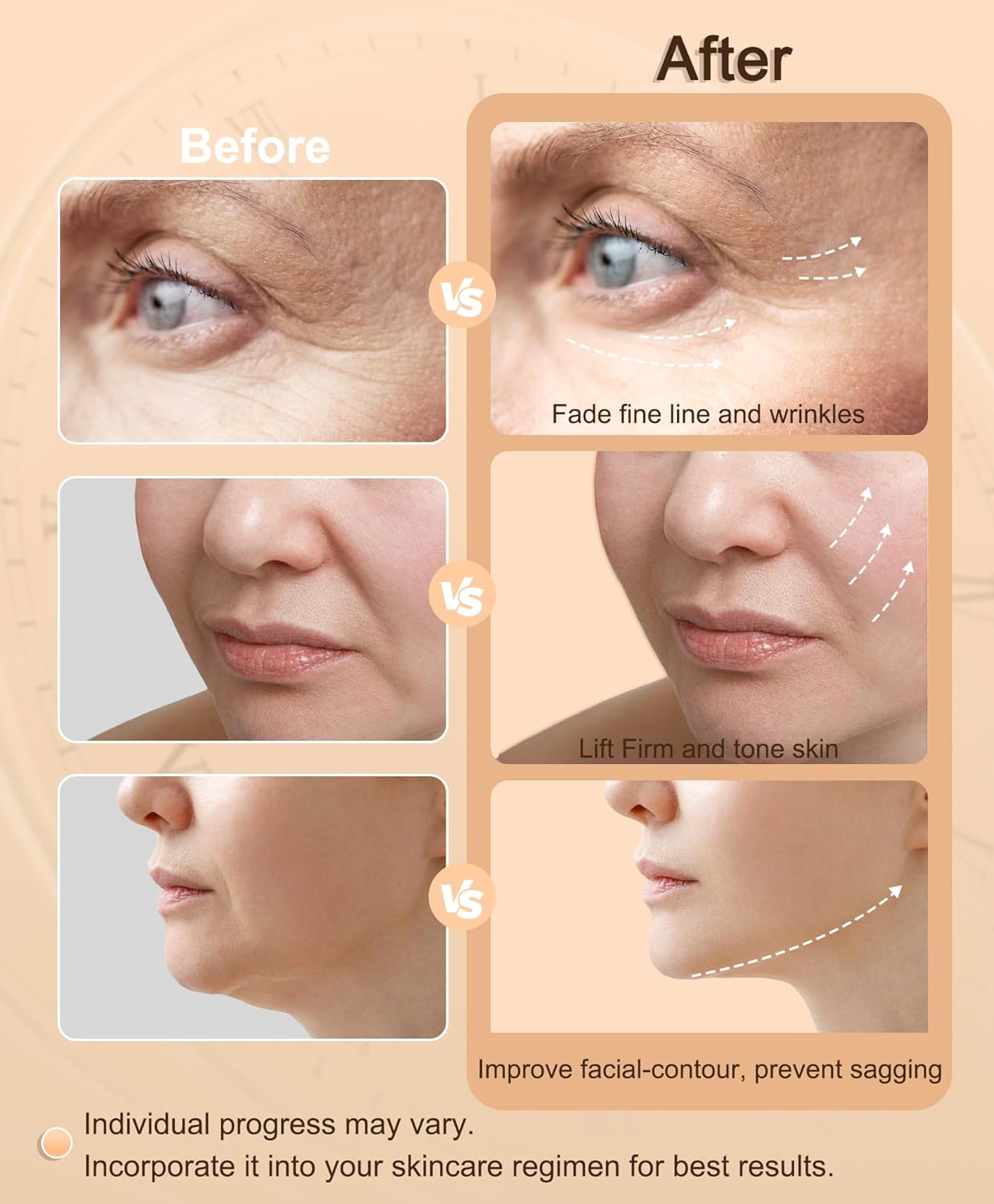 Radio Frequency Skin Tightening Device | 6 in 1 Home RF Face Beauty Device | Professional Facial Skin Tightening | Lifting | Wrinkle Reducing | Anti Aging | Depuff | Increase Absorption(with Gel)