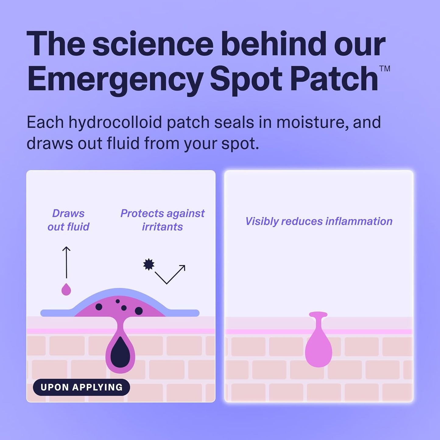 Curology Emergency Spot Pimple Patches for Face, Hydrocolloid Pimple Patches Fast-Acting, 80 Count