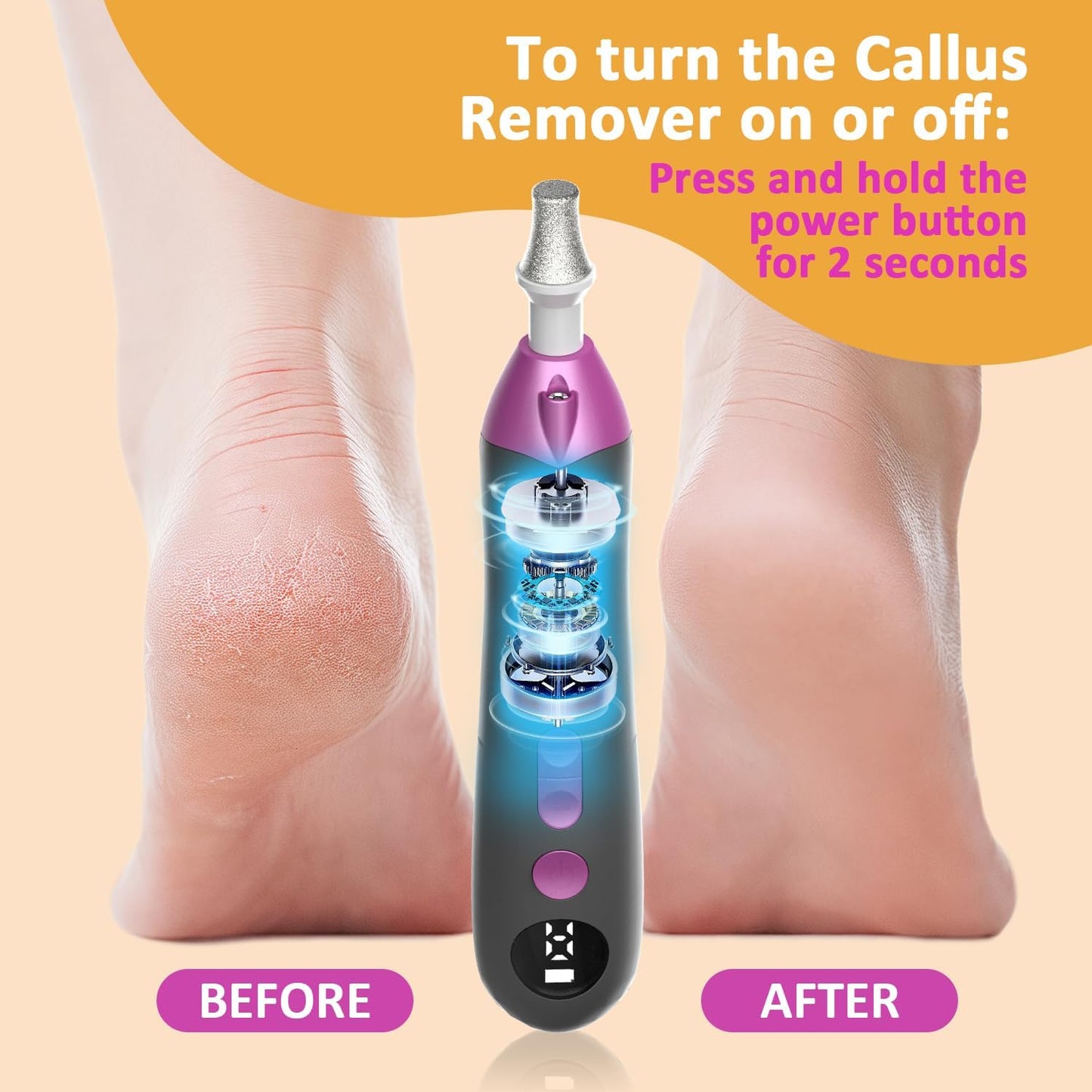 Callus Remover for Feet, Electric Foot Callus Remover - 8 Grinding Heads, 9 Speeds, Rechargeable Foot File - Professional Pedicure Tool for Hard Skin, Calluses & Cracked Feet