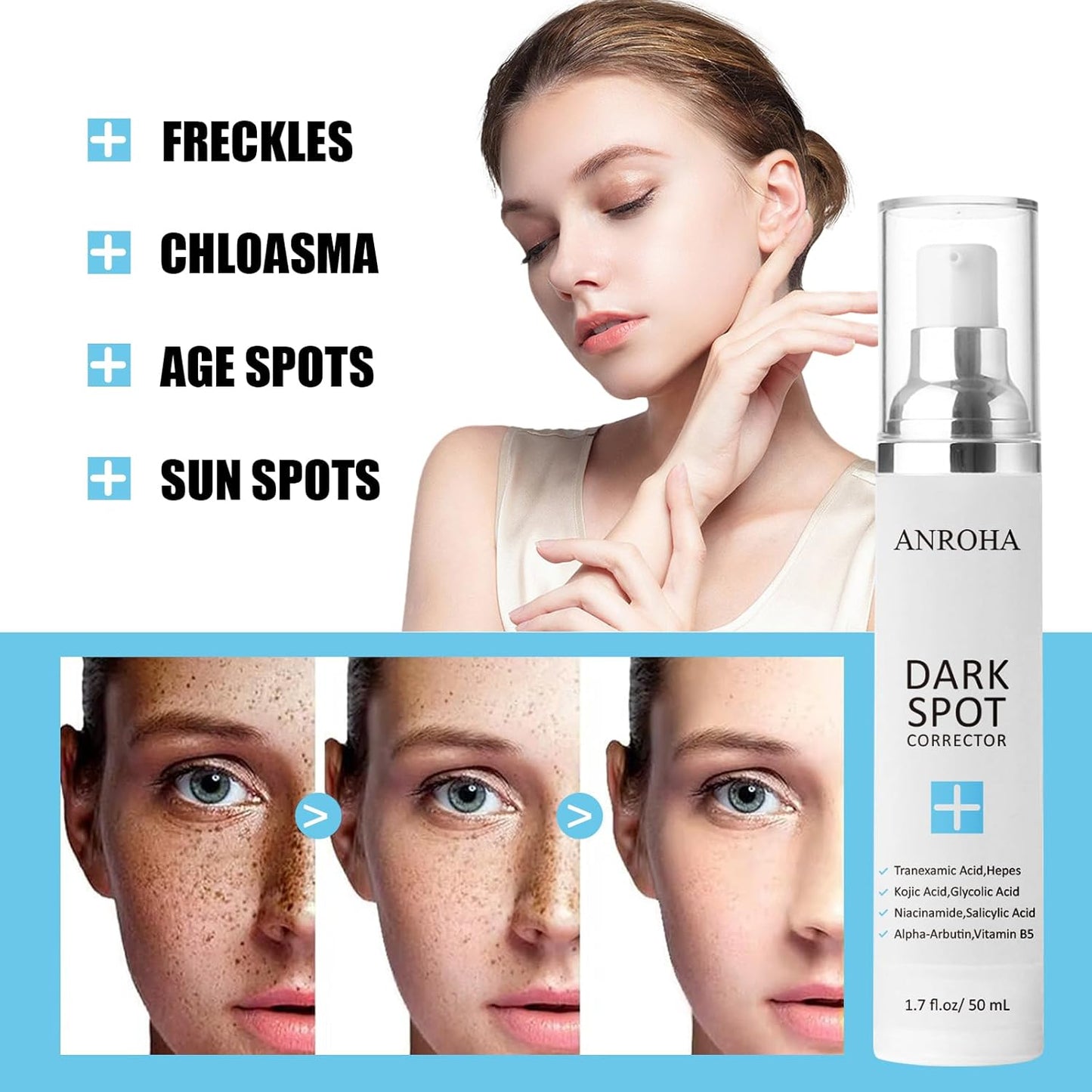 Dark Spot Remover for Face and Body Serum Promotes Anti-Aging Effect -Dark Spot Corrector for Women and Men with Niacinamide Kojic Acid & Salicyic Acid 50ml /1.7fl oz