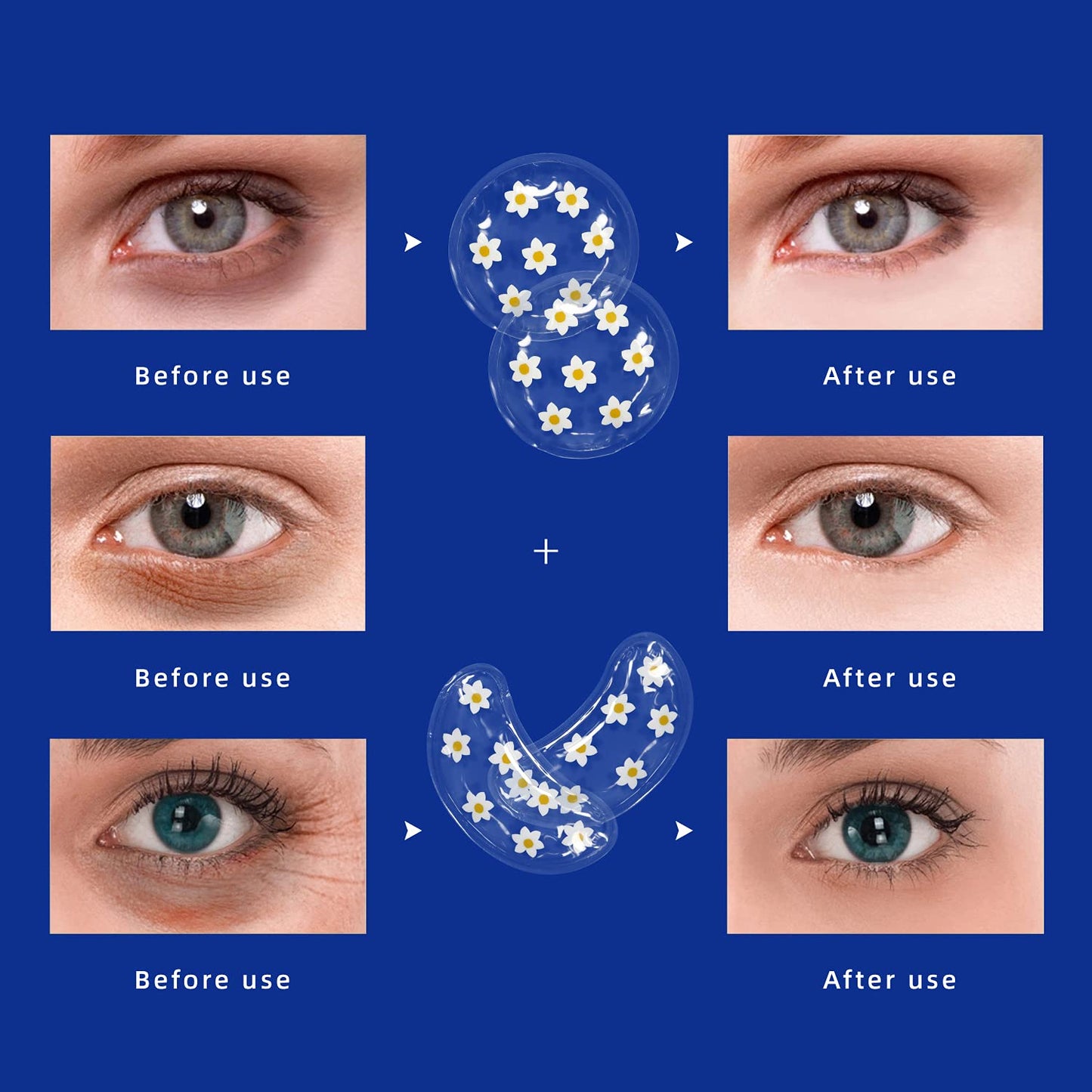 Gel Ice Pack Reusable Cooling Under Eye Pads and Patches, Hot Cold Treatment Pack for Redness,Pain Relief and Eye Relax