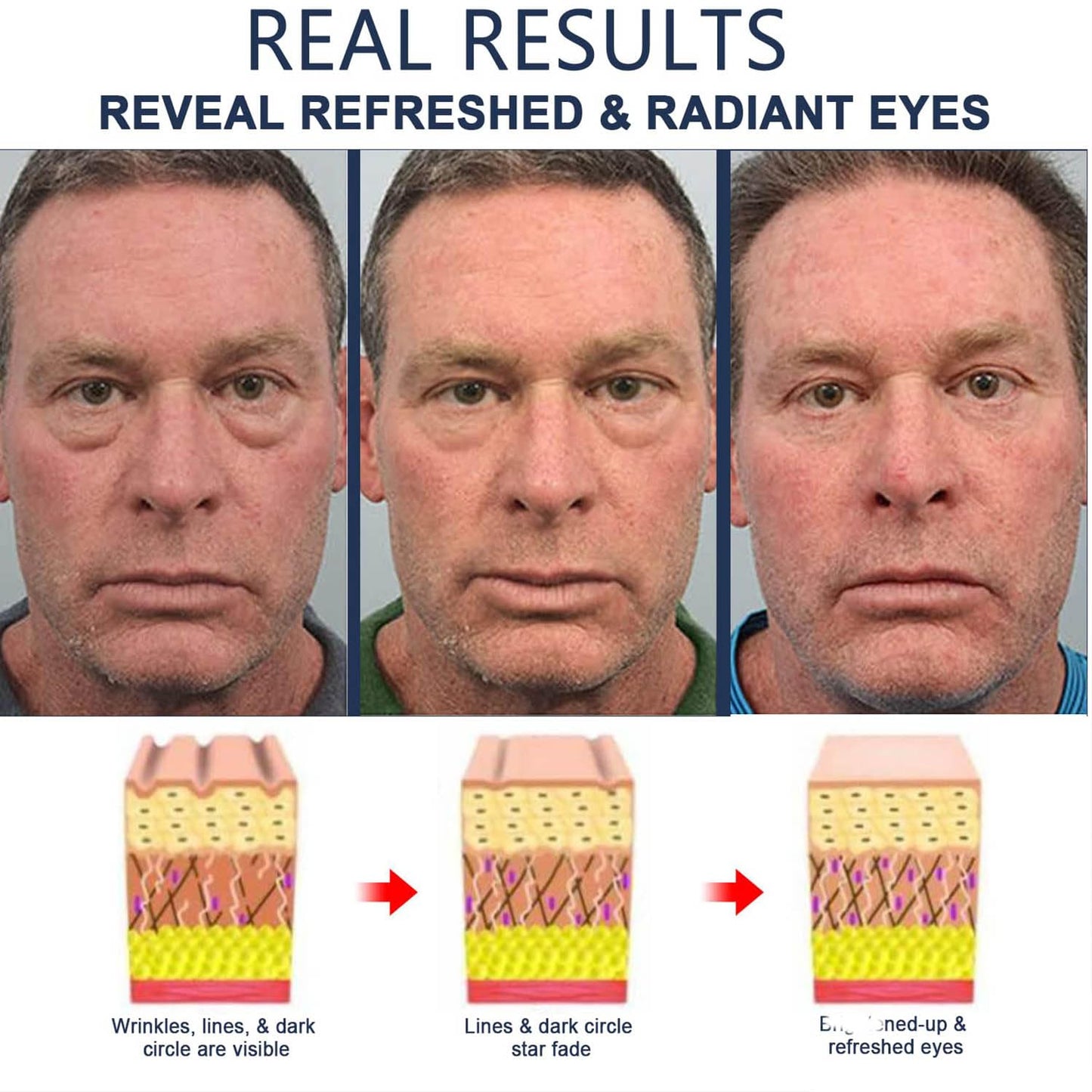 Men Eye Cream Anti Aging,Himse Awaken Peptide Depuffing Eye Gel,Men's Moisturizing Eye Cream Remove Eye Bags,Wrinkles,Fine Lines,Dark Circles,Puffiness and Bags Under Eyes (2PCS)