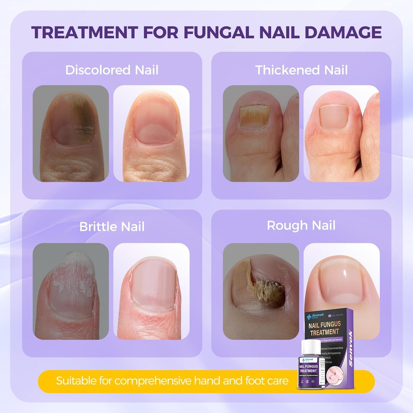 Toenail Treatment Extra Strength, Fast-Acting Toe Nail Treatments, Safety Restore and Renew Discolored & Damaged Nails, Improve Nail Health and Appearance