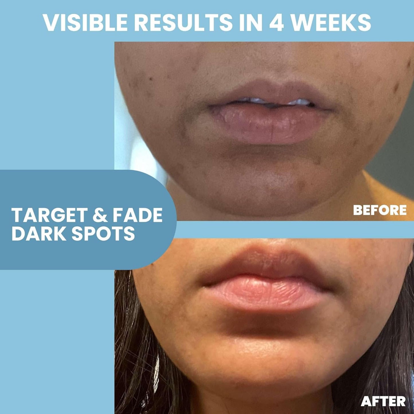 Eva Naturals Niacinamide 12% + Zinc Serum for Face – Dark Spot Remover, Pore Minimizer, Redness Relief, Hydrating Vitamin B3 with Botanical Hyaluronic Acid, Anti-Aging Serum for Clear Skin (2 Pack)