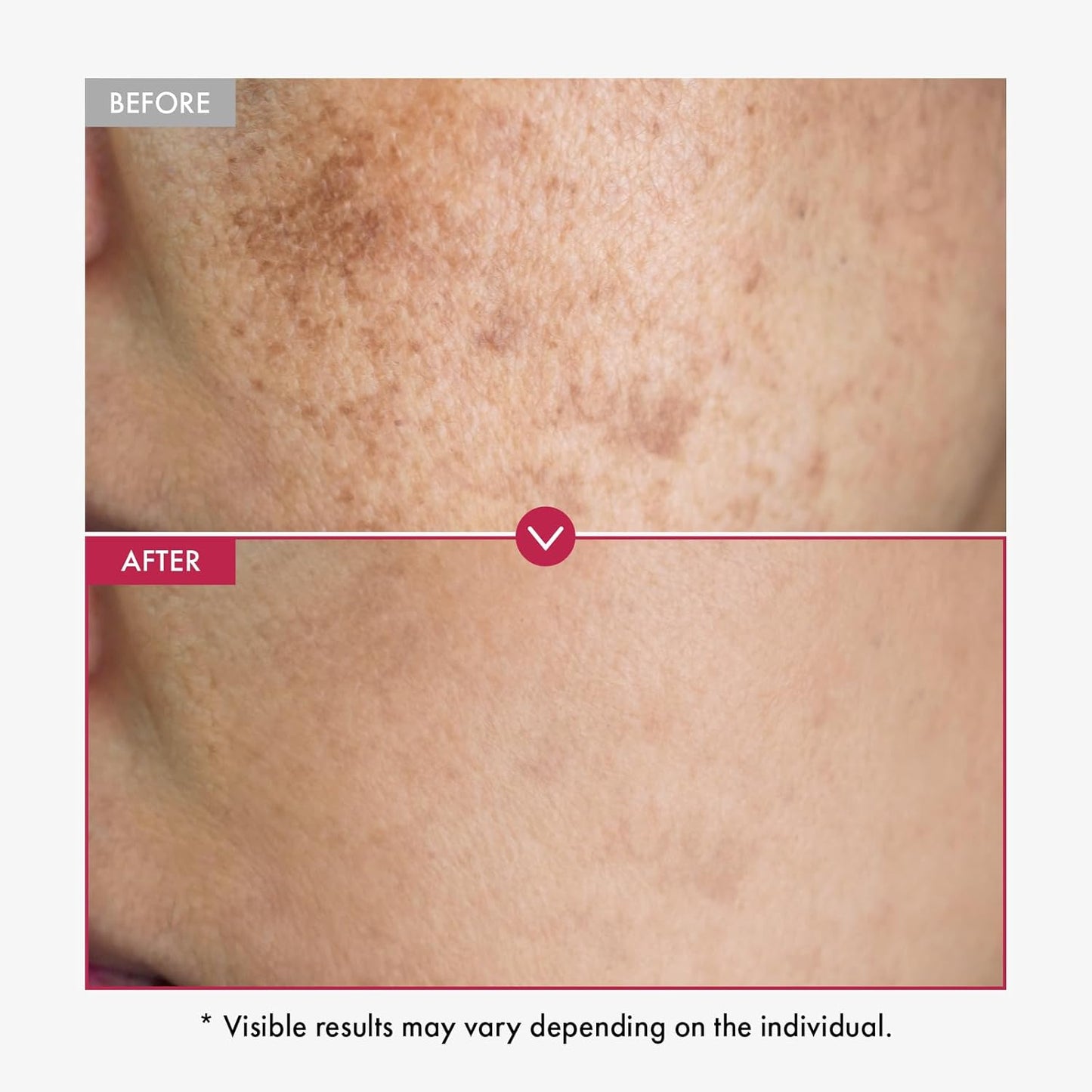 Niacinamide 10% + Tranexamic Acid 4% Serum, Arbutin 2%, Hyaluronic Acid, TXA Facial Serum, Glass Skin, Clarifying, Radiant Complexion with Natural Color, Korean Skin care, 33ml, 1.11 fl.oz.