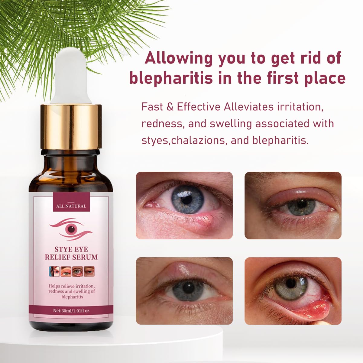 Stye Eye Treatment,Chalazion Remover,Stye Eye Relief Serum for Styes Chalazion and Blepharitis Treatment, Fast Relief,Mild Lash and Eye Cleanser