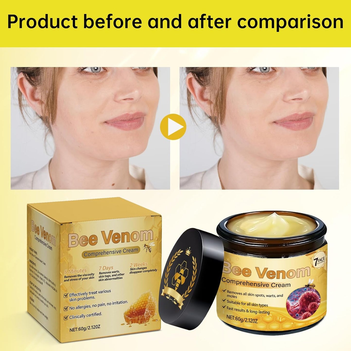 Bee Venom Comprehensive Cream, Firming & Wrinkle-Reducing Deeply Nourishes The Skin, Professional Bee Venom Skin Treatment Cream, Natural Serum Suitable for All Skin Types (2 Pack)