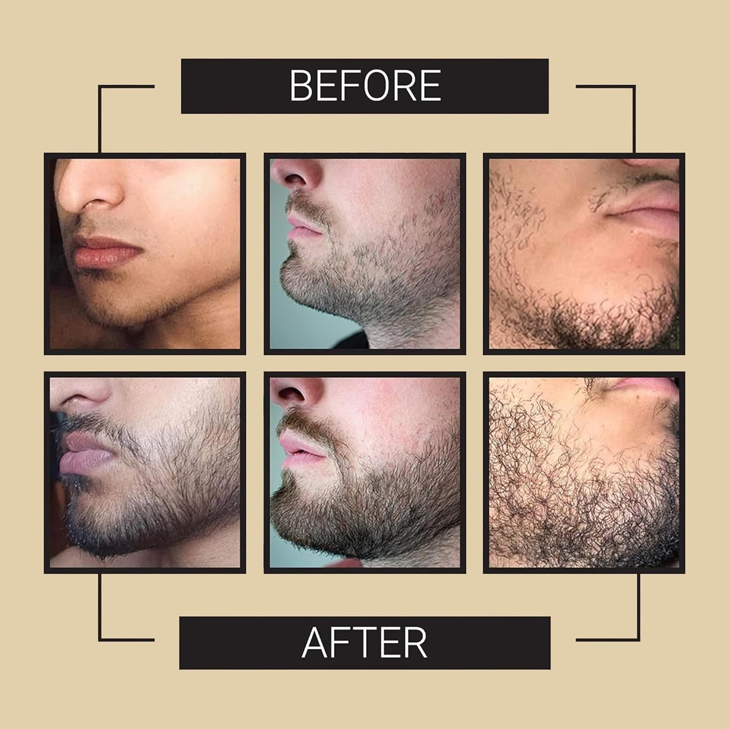 Crafted Beards Beard Growth Oil Serum - 1 fl Oz - Unscented - Helps Grow A Thicker Beard, Improves Beard Health, Fills in Thin and Patchy Spots - (1 Pack)