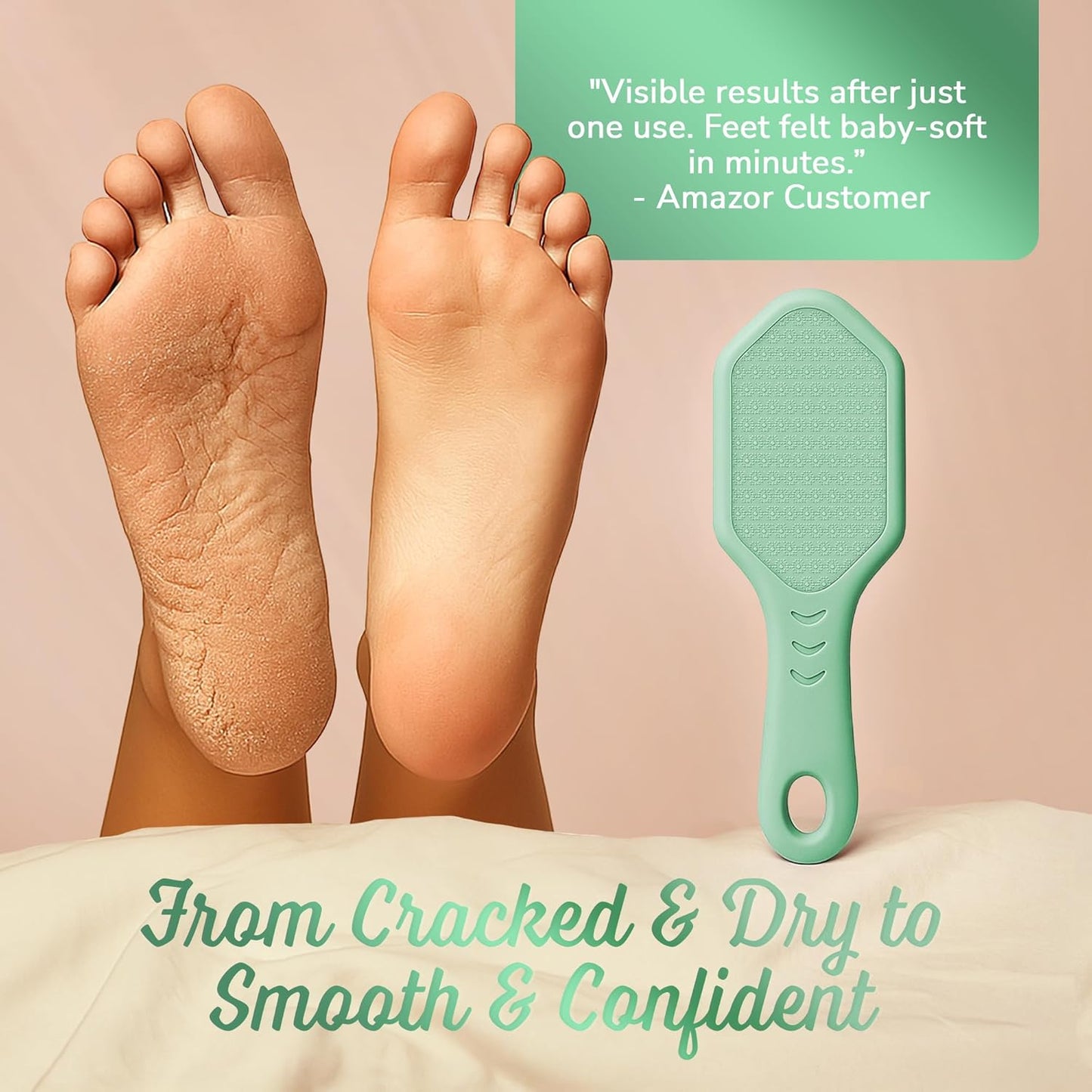 Silicone Foot Callus Remover - Nano Glass Foot File for Dead Skin and Cracked Heels - Callus Remover for Feet & Hard Skin - Ergonomic Foot Scrubber & Exfoliator for Soft, Smooth Feet - Green