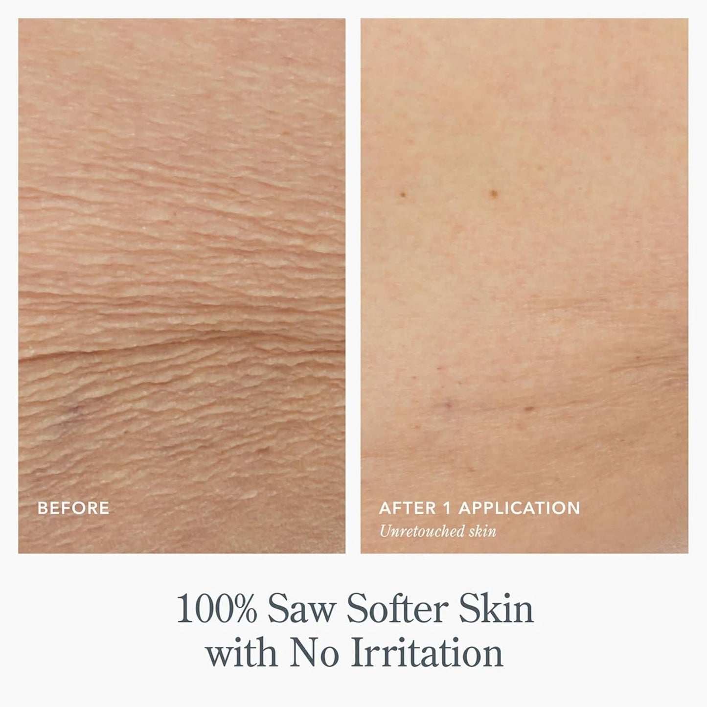 Beekman 1802 Pistachio & Dark Cherry Whipped Body Cream - 8 fl oz - Scented - Moisturizes, Soothes & Softens - With Coconut Oil and Mango Seed Butter - No Irritation - Good for Sensitive Skin