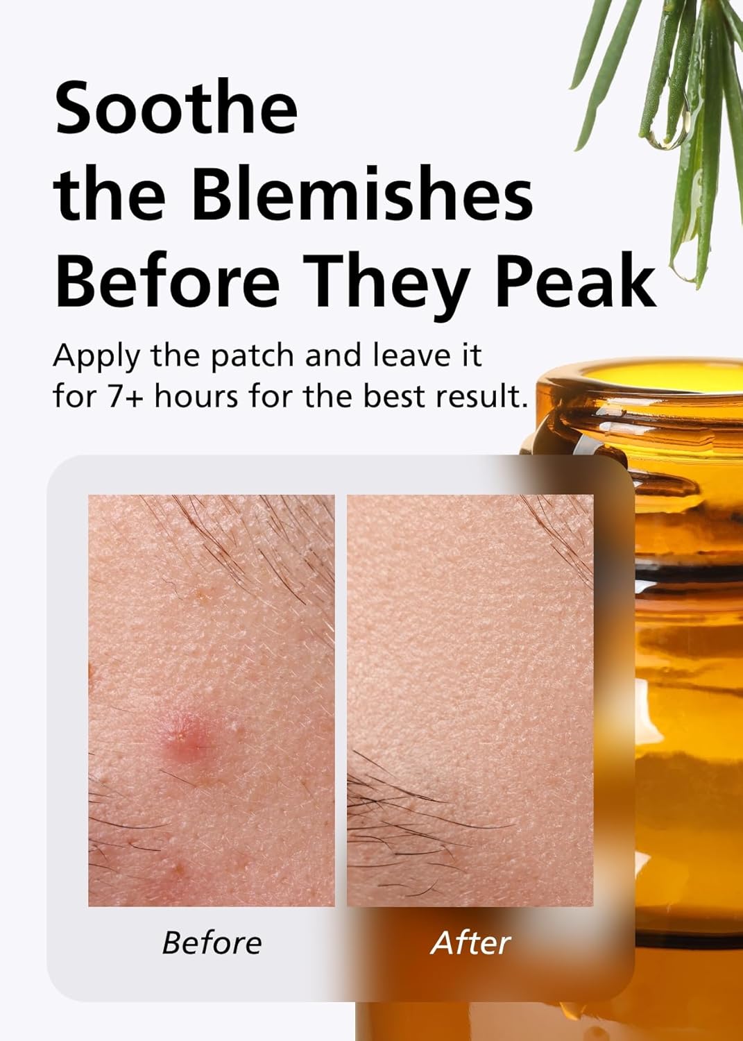 EasyDerm Relief Invisible Patch(42 counts) I Contains 10,000ppm of Tea Tree Oil, Pimple Patch, Ultra-slim 0.1mm, Waterpoof, Korean Pimple Patches Back to School MUST HAVE