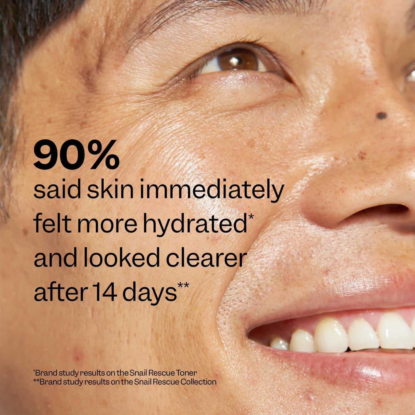 Peach Slices | Snail Rescue Blemish Busting Toner | 95% Snail Mucin | Pore Cleaner | Hydrates & Balances | Korean Skin Care | CICA | Hyaluronic Acid | Non-Comedogenic | Cruelty-Free | 4.05 oz