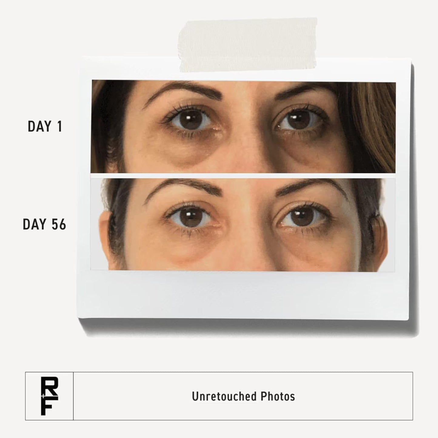 RODAN + FIELDS Active Hydration Bright Eye Complex | 15ml | Moisturizing Under Eye Cream for Dry Skin | Eye Treatment for Refreshed Appearance | Skincare