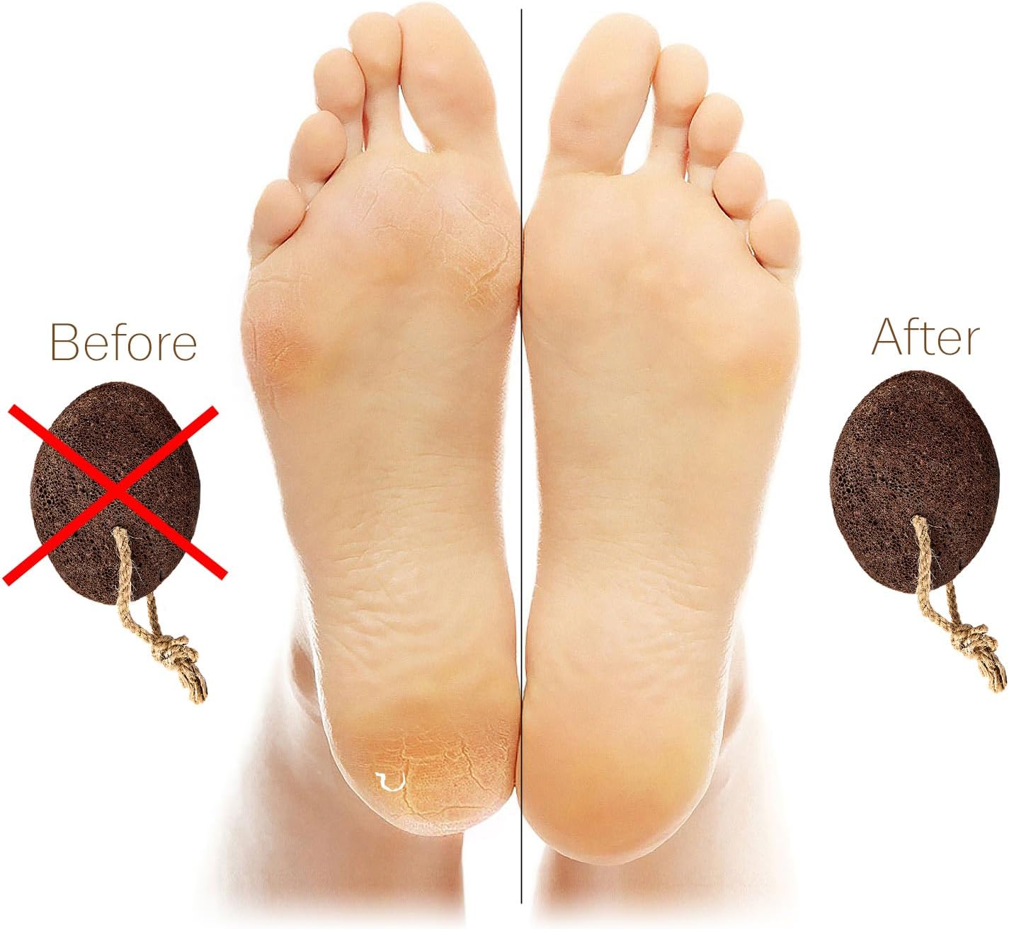 Pumice Stones for Feet - Natural Earth Lava Brown Pack of 2 - Callus Corn Remover for Feet Heels and Palm - Pedicure Exfoliation Tool - Dry Dead Skin Scrubber - Health Foot Care