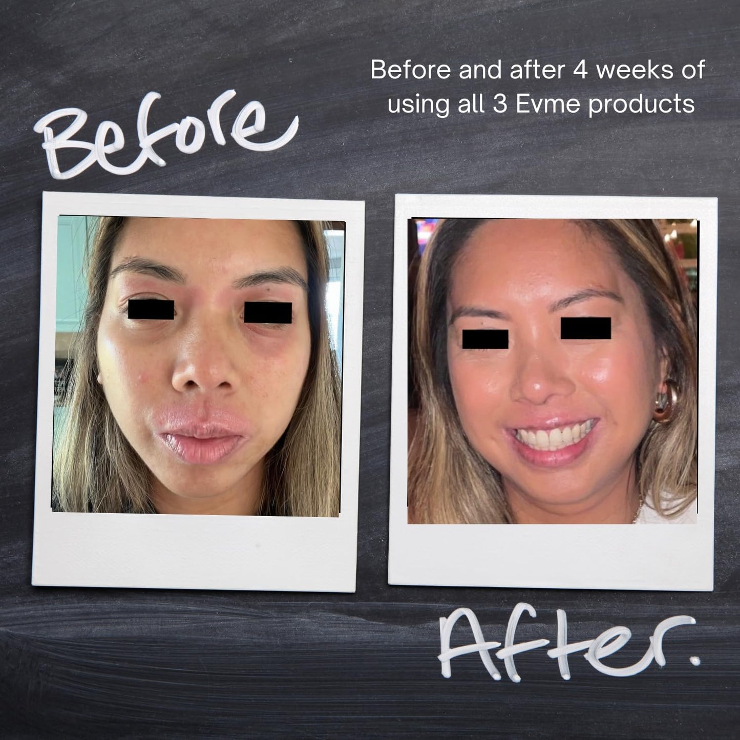 Evme Skincare Kit – Gentle Cleanser, Hydrating Serum & Night Cream – Nourishing for Sensitive Skin, Aiming for Sans-allergenic, Dermatologist-Tested, Fragrance-Free, Made in USA