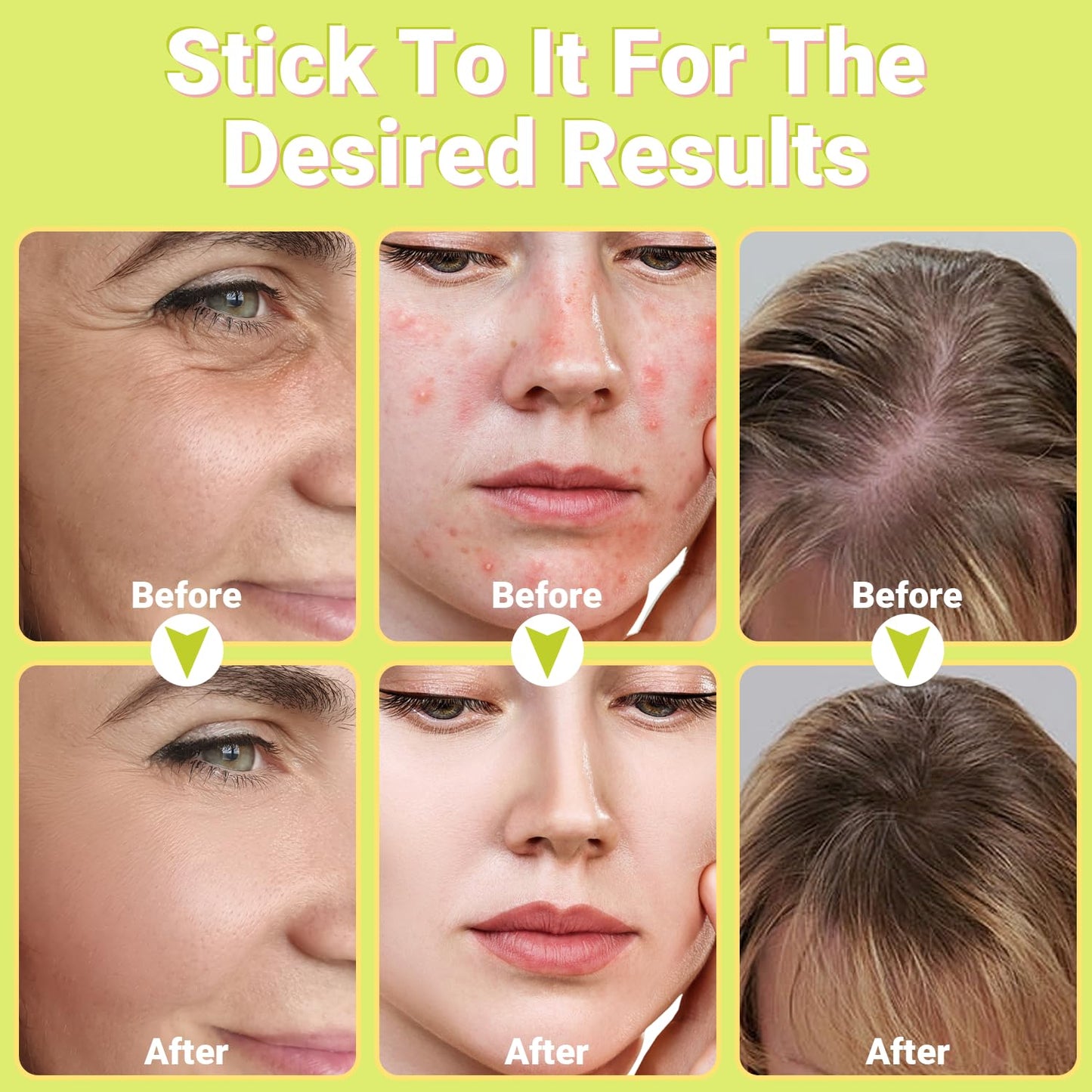 High Frequency Facial Wand - Uaike Orange Portable Handheld High Frequency Facial Machine - with 4 Pcs Orange Glass Tubes - at Home Skin Face Wand Device