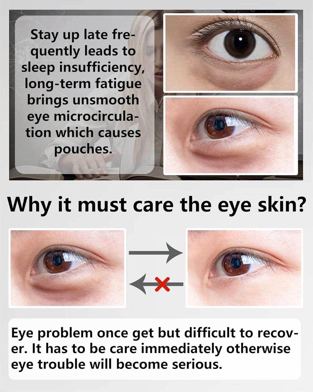 Under Eye Patches (60Pcs) - Upgraded Eye Mask Black Pearl & Collagen, Eye Treatment Mask, Under Eye Bag Treatment, Eye Mask for Puffy Eyes, Anti-Aging, Anti-Wrinkle, Fine Lines, Under eye Dark Circles