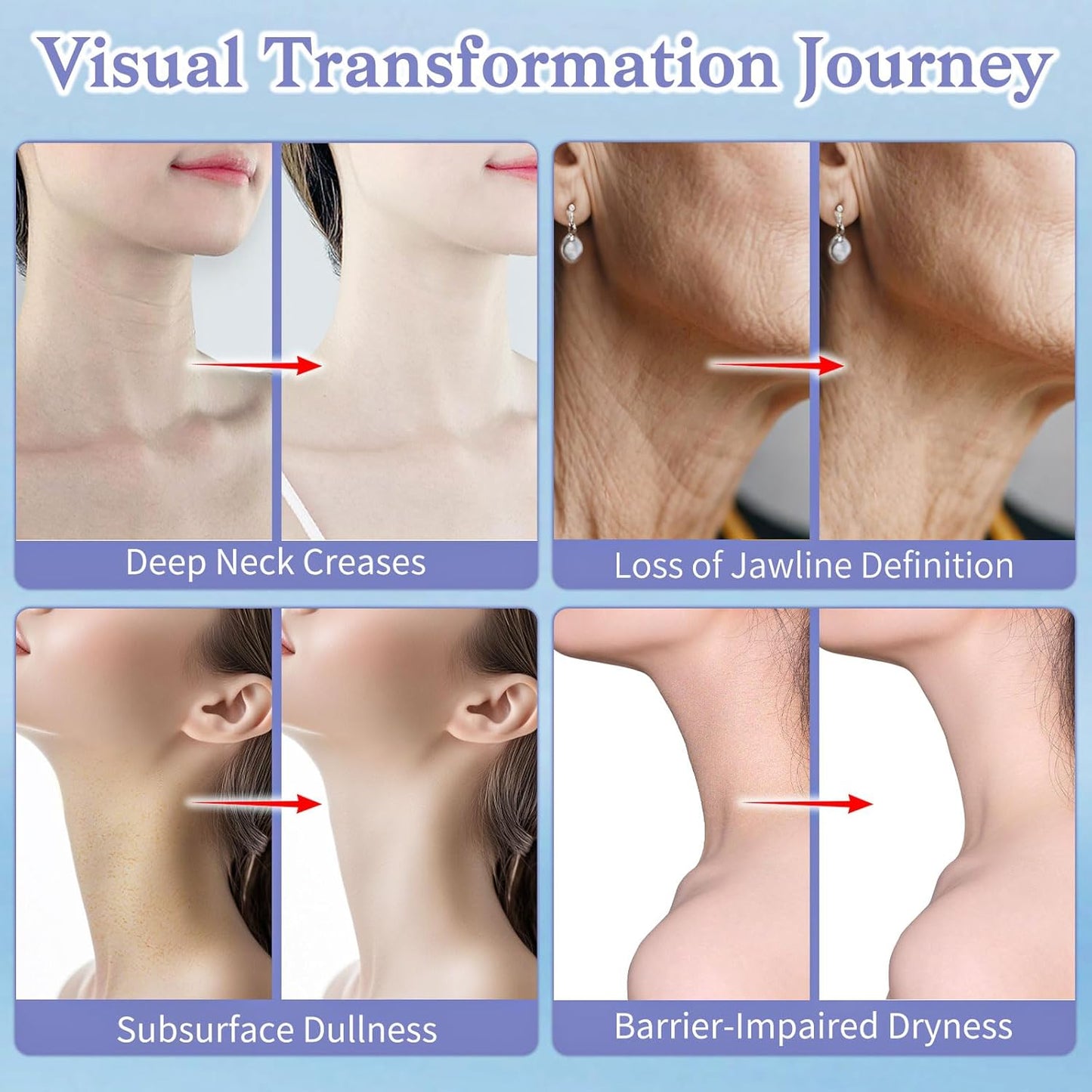 Neck Creams for Tightening and Firming - Anti Wrinkle & Treatment with Retinol Peptides, Ceramide - Overnight Moisturizer for All Skin Types - Sensitive Safe