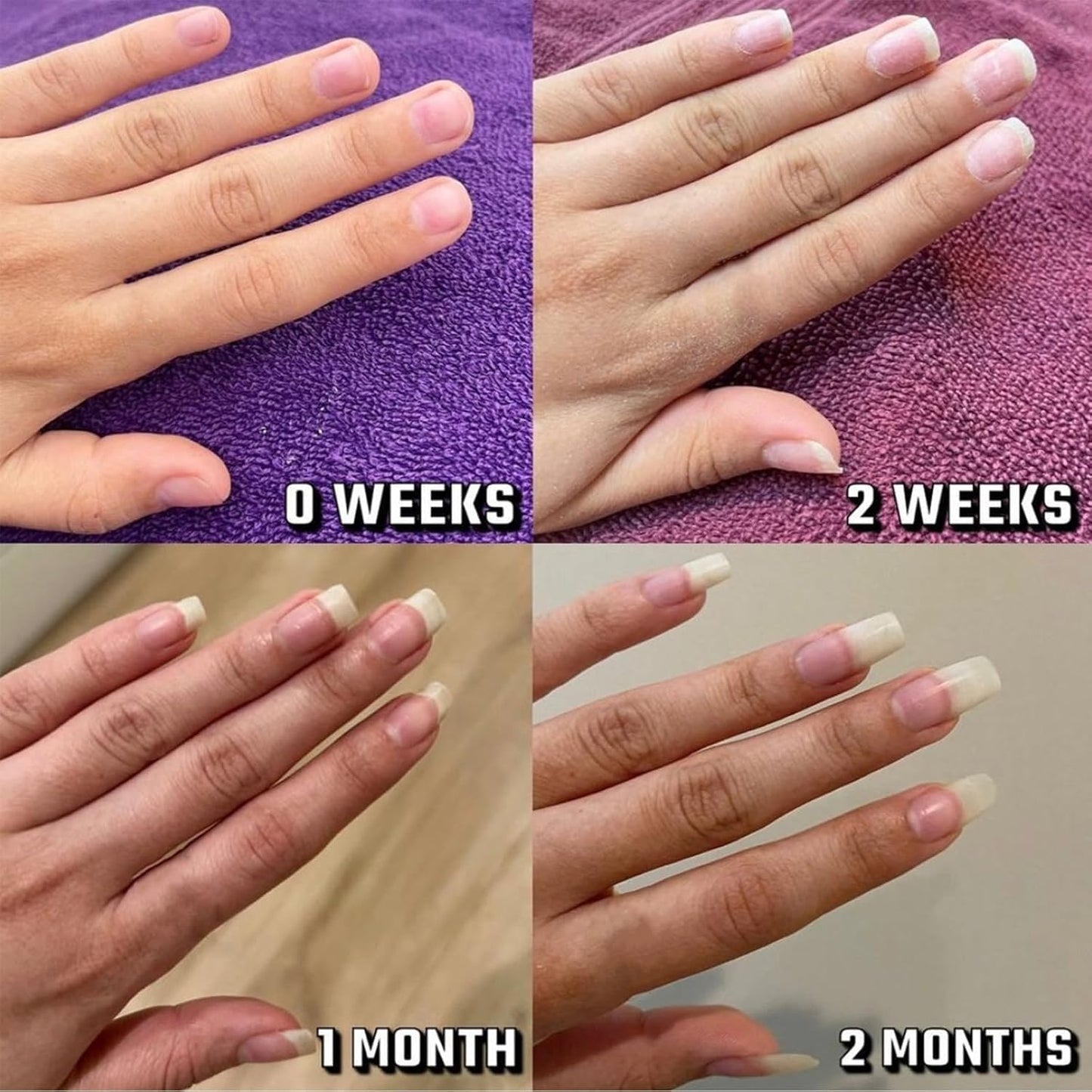 Radiant Nail 𝐆𝐫𝐨𝐰𝐭𝐡 Oil Pen, Cuticle Oil for Nails, Nail 𝐍𝐮𝐭𝐫𝐢𝐞𝐧𝐭 Oil Pen for Moisturize Strengthen 𝐁𝐫𝐢𝐠𝐡𝐭𝐞𝐧 Nails Care (2pcs, 2ml)