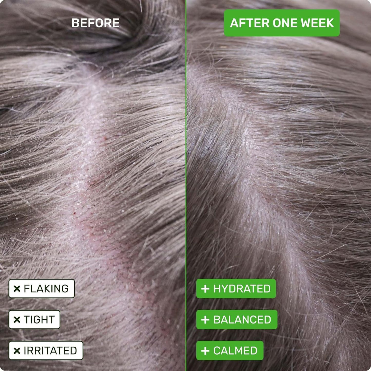 Ethique Scalp Health Shampoo Bar for itchy, dry, flaky scalps with Oatmeal - Plastic-Free, Vegan, Cruelty-Free, 3,88 oz - Formerly Heali Kiwi