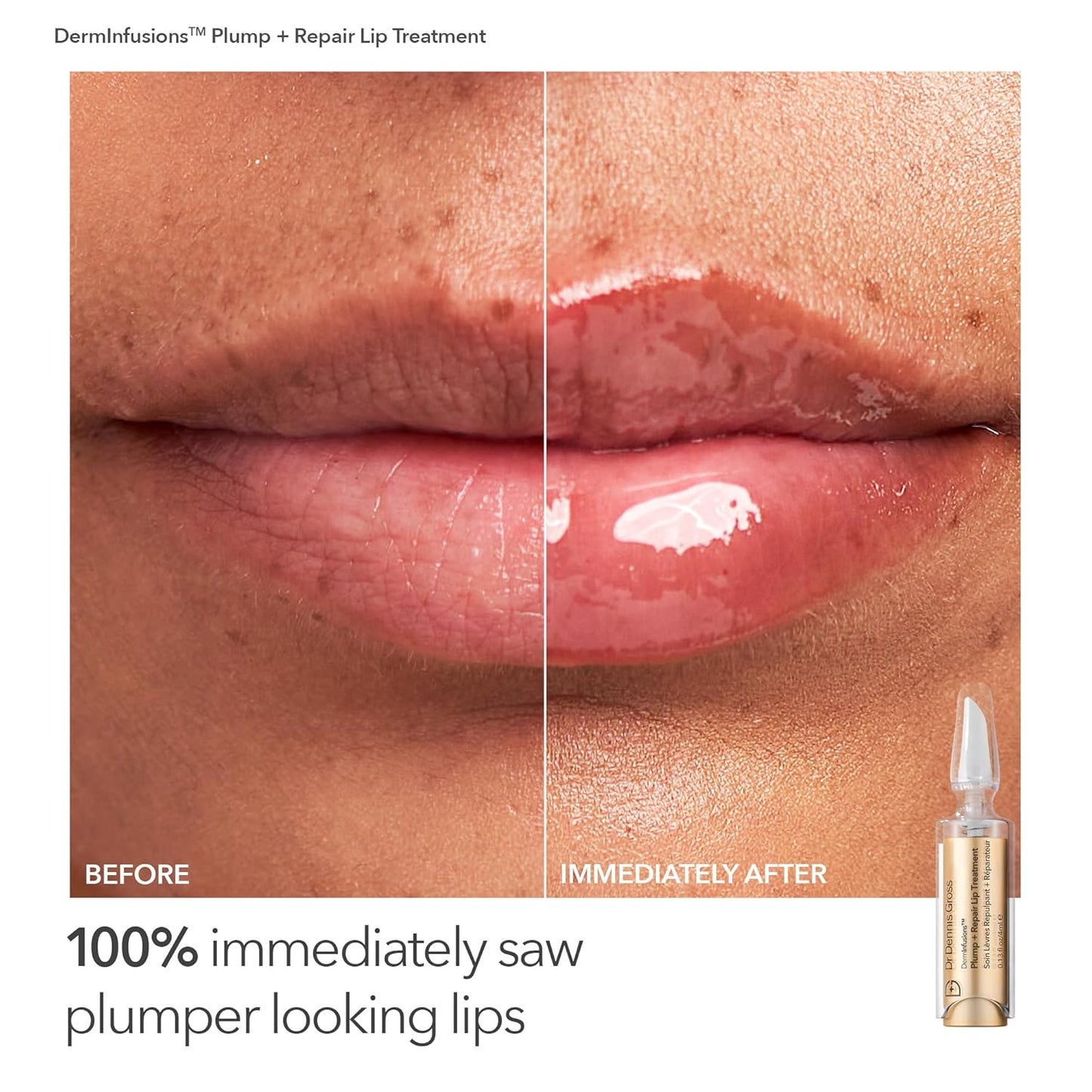 Dr. Dennis Gross Fill, Plump & Firm Kit – DermInfusions™ Hyaluronic Acid Serum, Eye Cream & Lip Treatment | Boost Hydration, Smooth Fine Lines & Enhance Volume | Limited Edition Gift Set