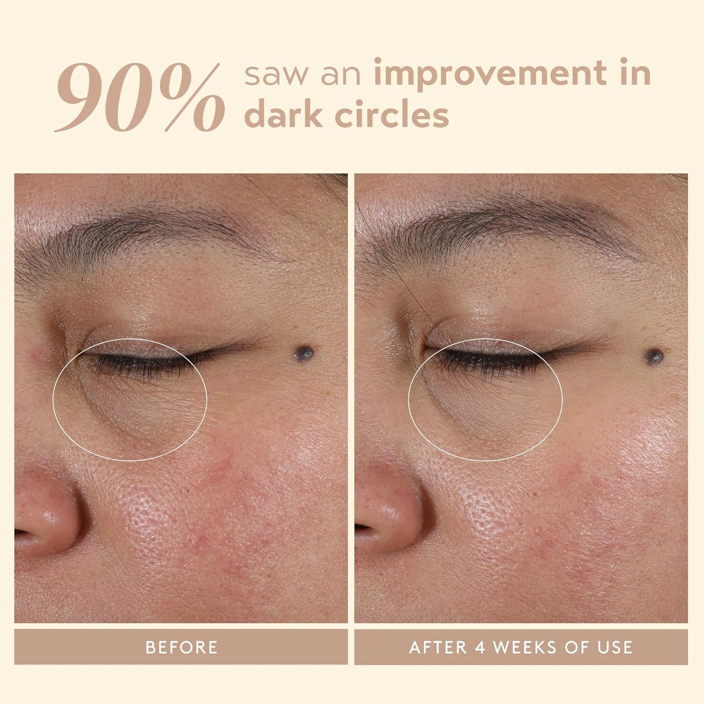 SHANI DARDEN Intensive Eye Renewal Cream, Hydrating Under Eye Cream for Dark Circles, Fine Lines, Wrinkles & Crows Feet with Niacinamide, Shea Butter & Ceramide, Crease-Free & Makeup-Ready, 0.50 fl oz