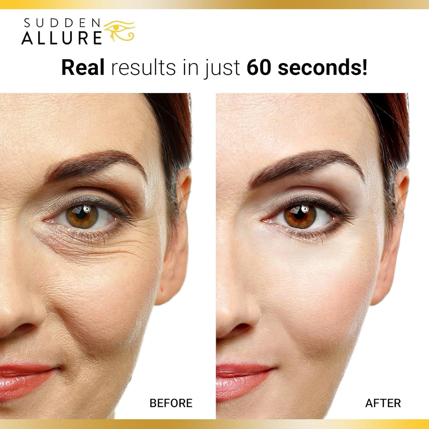 Sudden Allure Instant Under Eye Treatment Serum – Erase Under Eye Bags, Dark Circles, Wrinkles & Lift Sagging Eyes - Instantly Tighten & Firm - Reduce Eye Bags & Crows Feet | Made in USA (10 ml)