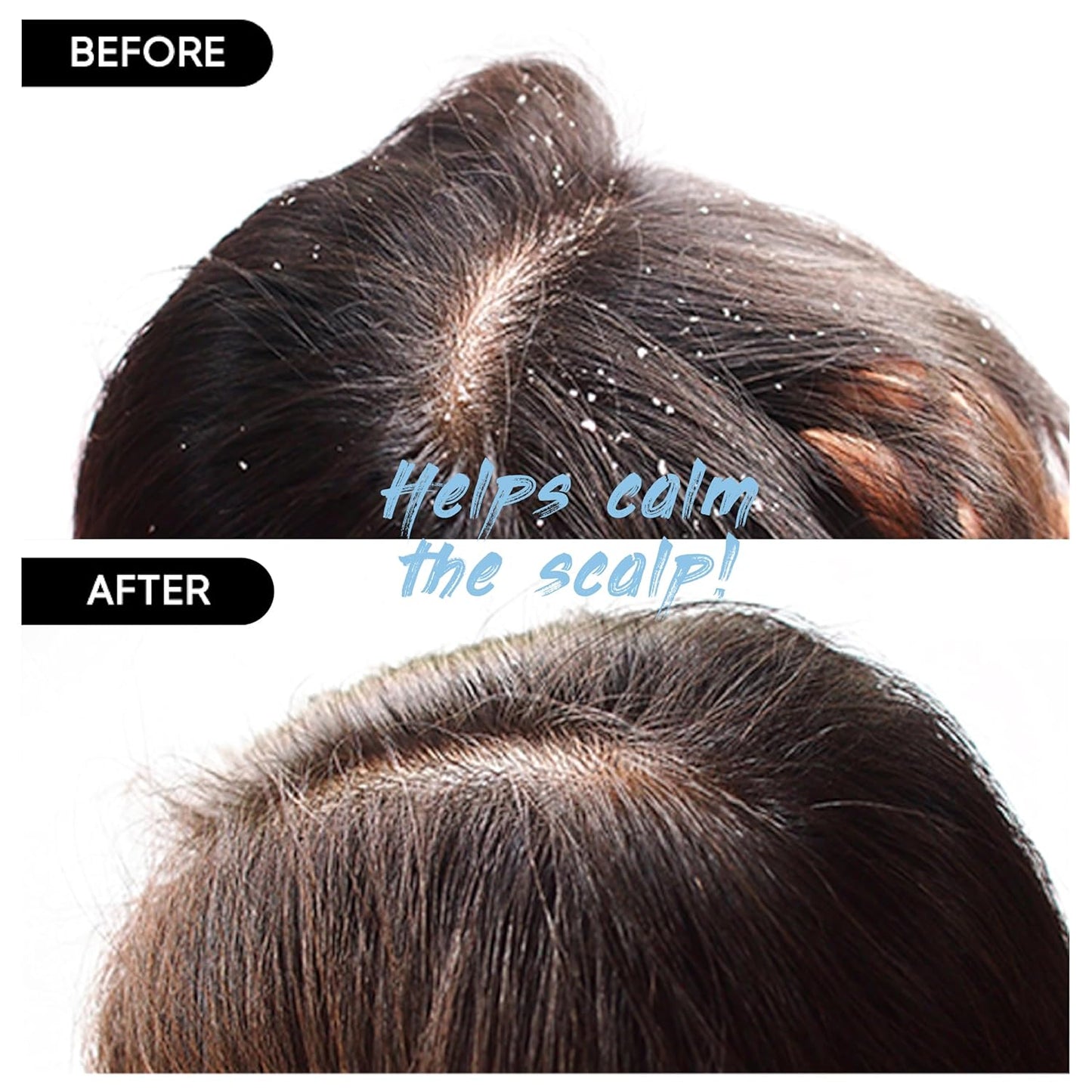 Red Bean Shampoo Bar 2.0 - Hydrating & Moisturizing Natural Hair Soap Bar Shampoo for Hair Color & Scalp Nourishment - Bathing Soap Solid Shampoo for All Hair Types (120g, 4.23oz)