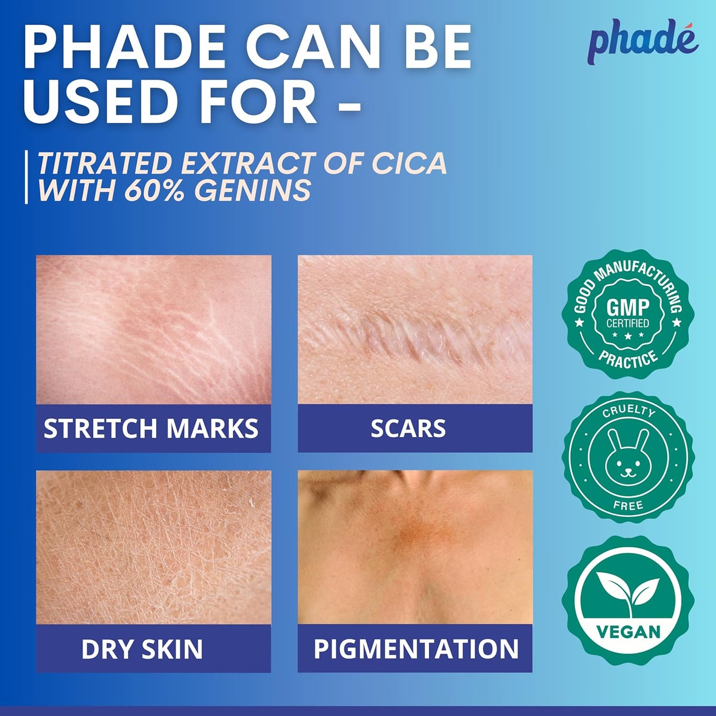 Phade Stretch Mark Cream with CICA - 200ml | Pregnancy, Scars, Uneven Skin Tone, Aging | Dermatologist Tested, Clinically Proven Formula for Stretch Marks, Hydration, and Skin Repair