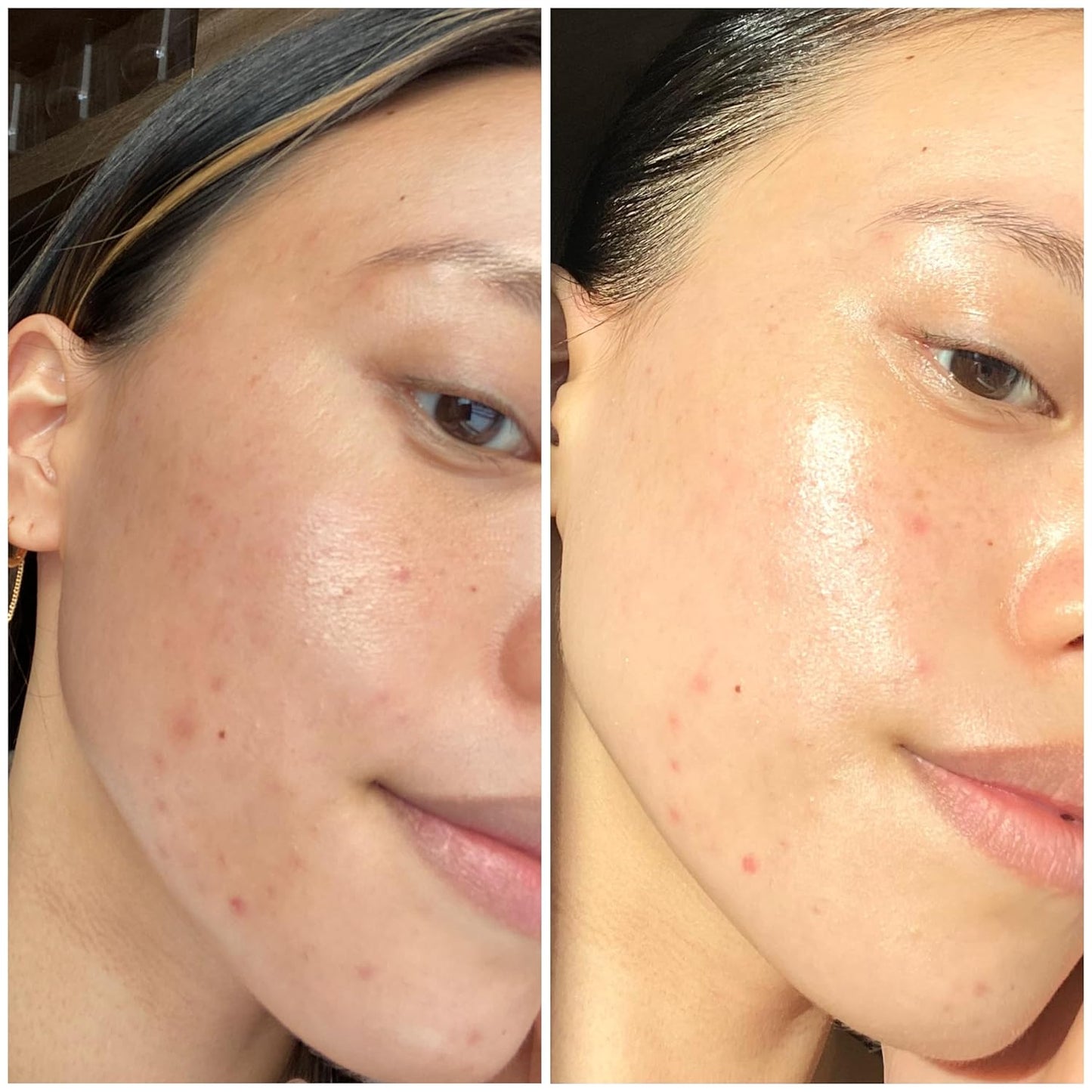 Sand & Sky Tasmanian Spring Water Intense Hydration Face Mask with Pentavitin & Hyaluronic Acid - Barrier Boosting Mask for Sensitive Skin, Soothes Redness