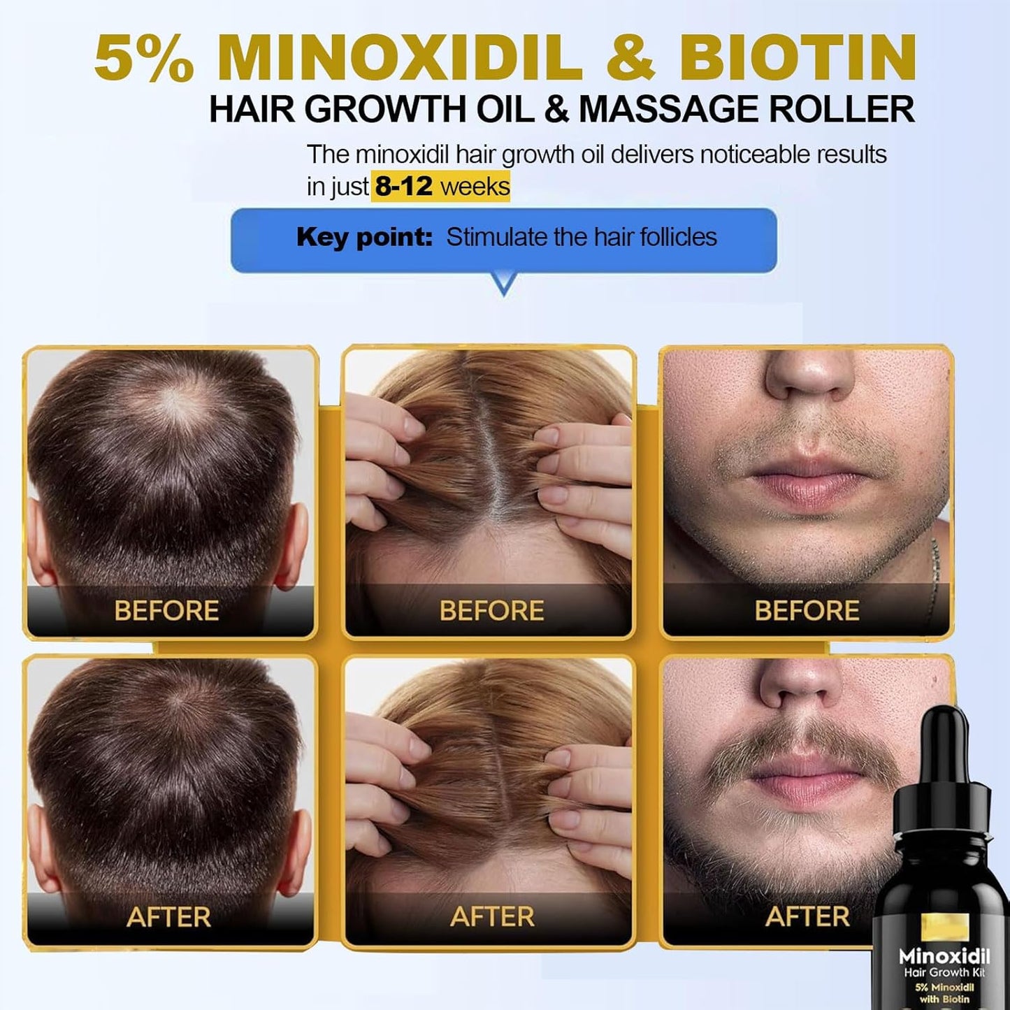 5% Minoxidil for Men Hair, Minoxidil Hair Growth Serum for Women Hair Growth, Men Beard Growth, Hair Loss Treatment with Dropper Applicator & Massage Tool