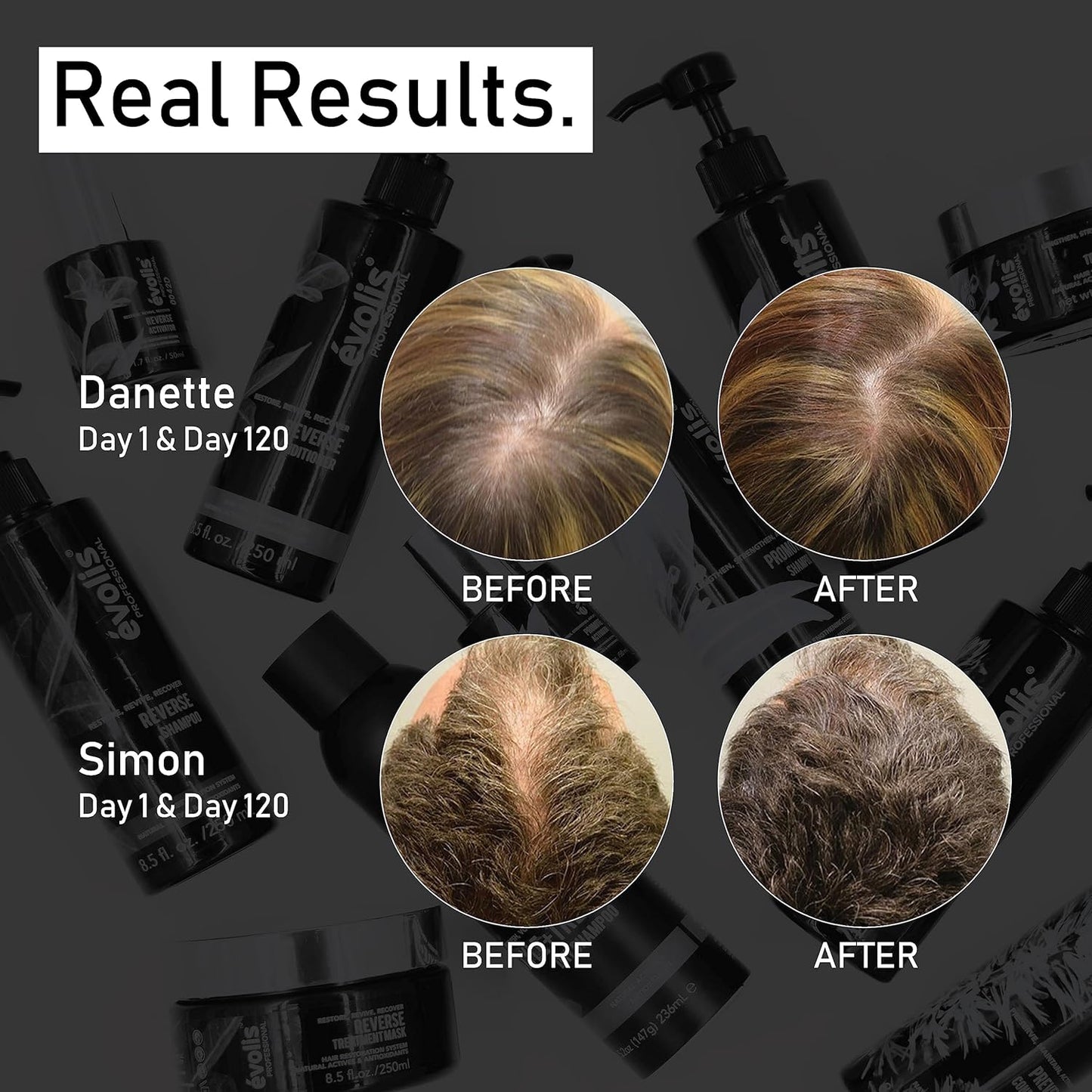 EVOLIS Promote Scalp Activator - Scalp Serum for Longer, Stronger Hair – Hair Repair Treatment – Hydrating Hair Growth Serum with Baobab & FGF5 Blockers (1.7 fl oz)