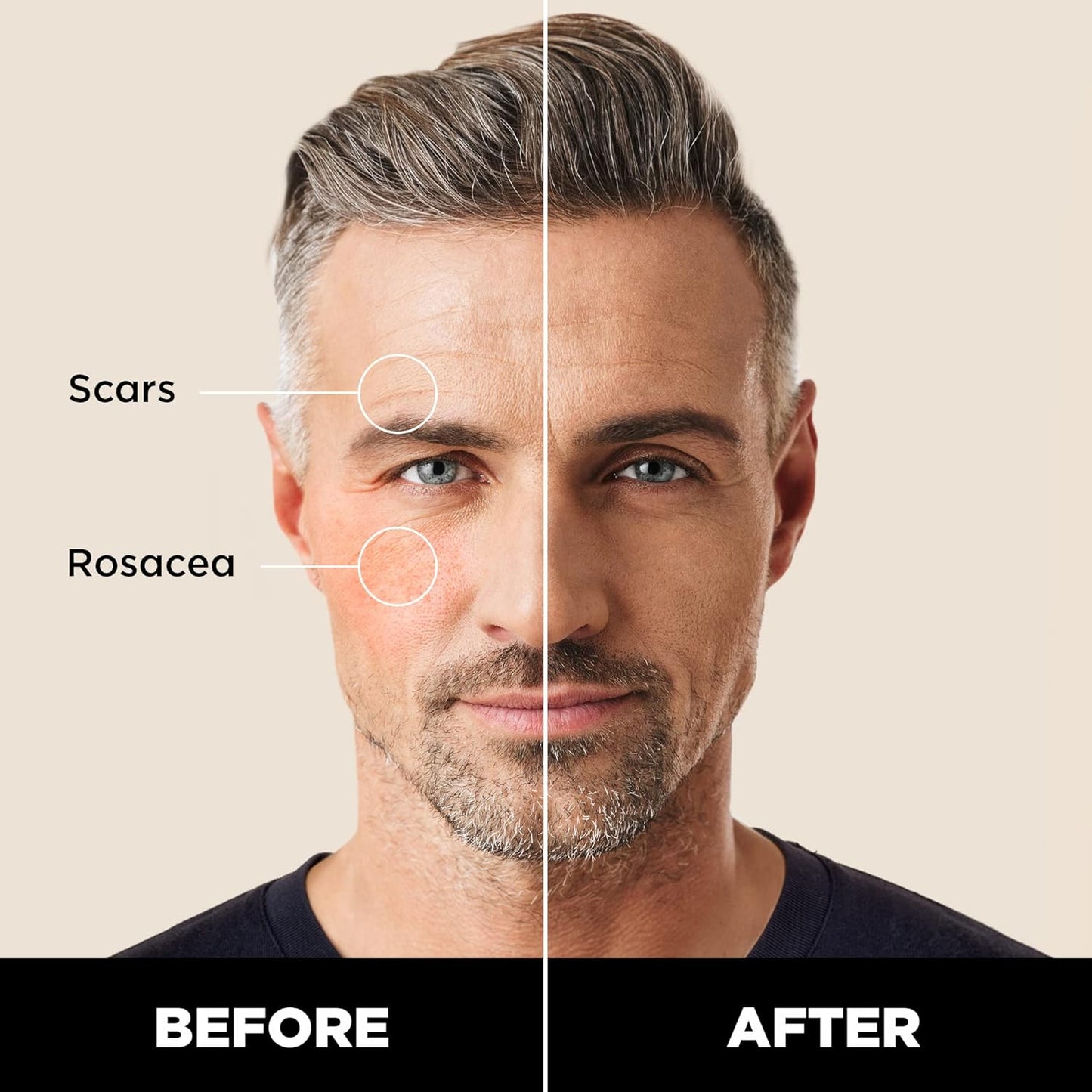 Stryx Concealer Stick Tool for Men, Medium Mahogany - Natural Pigments Hides Imperfections, Acne, Razor Burns, Scars, & Rosacea - Highly Adaptable Shades for Easy, Undetectable Coverage